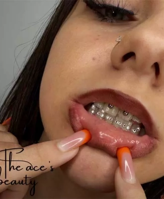 the-aces-beauty-strass-dentaire-4